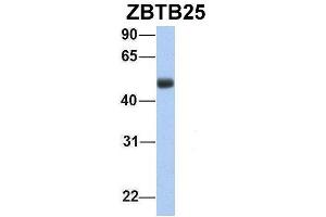 Host:  Rabbit  Target Name:  ZBTB25  Sample Type:  Human Fetal Lung  Antibody Dilution:  1. (ZBTB25 Antikörper  (Middle Region))