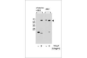 Western blot analysis of extracts from NIH-3T3 cells,untreated or treated with PDGF,using Phospho-Akt(Ser473)(left) or Akt Antibody (right). (AKT1 Antikörper  (pSer473))