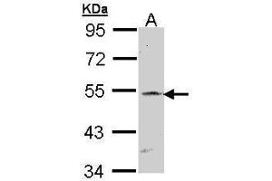 WB Image Sample (30 ug of whole cell lysate) A: Raji 7. (RBPJ Antikörper)