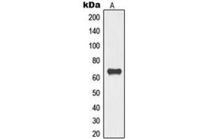 Western blot analysis of TOR1AIP1 expression in HeLa (A) whole cell lysates. (TOR1AIP1 Antikörper  (Center))