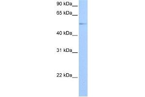 WB Suggested Anti-GRK4 Antibody Titration: 0. (GRK4 Antikörper  (Middle Region))