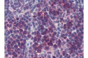 Mouse Spleen (formalin-fixed, paraffin-embedded) stained with TSLPfollowed by biotinylated goat anti-rabbit IgG secondary antibody, alkaline phosphatase-streptavidin and chromogen. (Thymic Stromal Lymphopoietin Antikörper)