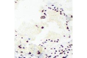 Immunohistochemical analysis of TAFI110 staining in mouse lung formalin fixed paraffin embedded tissue section. (TAF1C Antikörper)
