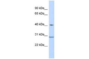 WB Suggested Anti-ZNF396 Antibody Titration:  0. (ZNF396 Antikörper  (Middle Region))