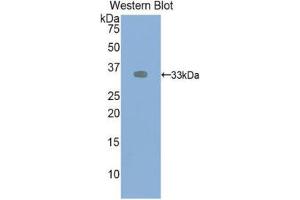 Western Blotting (WB) image for anti-VEGF Receptor 2 (VEGFR2) (AA 46-320) antibody (ABIN1078658) (VEGFR2/CD309 Antikörper  (AA 46-320))