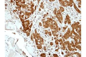 IHC-P Image Immunohistochemical analysis of paraffin-embedded A549 xenograft, using BCL2L15, antibody at 1:500 dilution. (BCL2-Like 15 Antikörper)