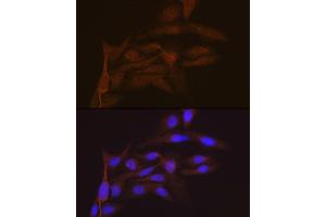 Immunofluorescence analysis of U-2 OS cells using SMC4 Rabbit mAb (ABIN7270618) at dilution of 1:100 (40x lens). (SMC4 Antikörper)