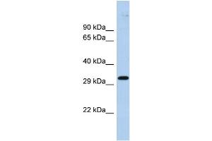 Host:  Rabbit  Target Name:  ZNF397  Sample Type:  Fetal Brain lysates  Antibody Dilution:  1. (ZNF397 Antikörper  (Middle Region))