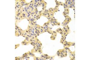 Immunohistochemistry of paraffin-embedded rat lung using MAP2K1 antibody. (MEK1 Antikörper  (AA 1-100))