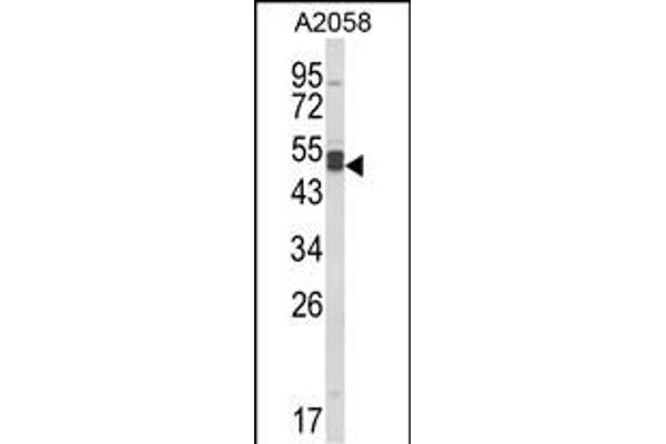 AGPAT3 antibody  (AA 241-269)