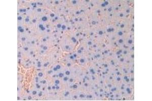 Detection of IAP in Mouse Liver Tissue using Polyclonal Antibody to Integrin Associated Protein (IAP) (CD47 Antikörper  (AA 18-219))