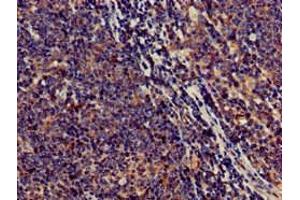 Immunohistochemistry of paraffin-embedded human lymph node tissue using ABIN7170561 at dilution of 1:100 (SAMD8 Antikörper  (AA 1-152))