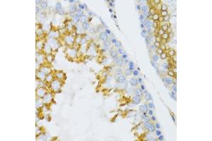 Immunohistochemistry of paraffin-embedded mouse testis using PTN Antibody (ABIN3017413, ABIN3017414, ABIN1682388 and ABIN6220085) at dilution of 1:100 (40x lens). (Pleiotrophin Antikörper)