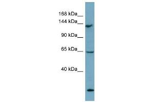 LATS1 antibody used at 1 ug/ml to detect target protein.