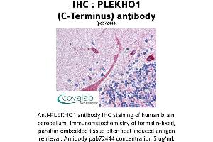 Image no. 1 for anti-Pleckstrin Homology Domain Containing, Family O Member 1 (PLEKHO1) (C-Term) antibody (ABIN1738152) (PLEKHO1 Antikörper  (C-Term))