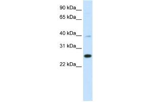 WB Suggested Anti-YAF2 Antibody Titration:  0.