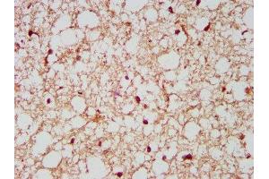 IHC image of ABIN7161257 diluted at 1:500 and staining in paraffin-embedded human brain tissue performed on a Leica BondTM system. (NCDN Antikörper  (AA 403-516))