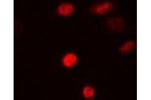 Immunofluorescent analysis of SAMHD1 staining in MCF7 cells. (SAMHD1 Antikörper)