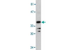 Western blot analysis of MYD88 in Jurkat whole cell lysate with MYD88 polyclonal antibody  at 1 : 500 dilution. (MYD88 Antikörper  (AA 233-248))