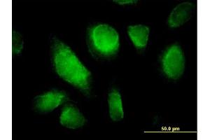 Immunofluorescence of purified MaxPab antibody to RHOQ on HeLa cell. (RHOQ Antikörper  (AA 1-205))