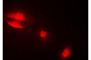 Immunofluorescent analysis of Cytokeratin 14 staining in MCF7 cells. (KRT14 Antikörper  (N-Term))