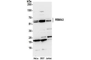Western Blotting (WB) image for anti-RNA Binding Motif Protein 42 (RBM42) (AA 430-480) antibody (ABIN7450643) (RBM42 Antikörper  (AA 430-480))