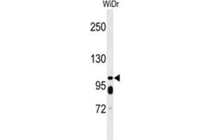 Western Blotting (WB) image for anti-ATP-Binding Cassette, Sub-Family C (CFTR/MRP), Member 11 (ABCC11) antibody (ABIN5021768) (ABCC11 Antikörper)