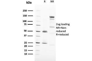 SDS-PAGE Analysis Purified HER-2 Monospecific Mouse Monoclonal Antibody (ERBB2/3093). (ErbB2/Her2 Antikörper  (AA 311-462))
