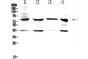 Western blot analysis of HSD17B4 using anti- HSD17B4 antibody . (HSD17B4 Antikörper  (C-Term))