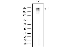 Western blot analysis of lysates from Mouse brain, using ALS2 Mouse Monoclonal Antibody at 1/1000 dilution.