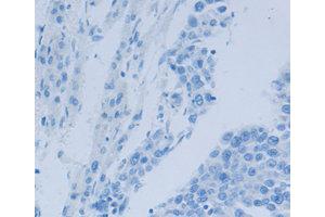 Immunohistochemistry (IHC) image for anti-Nephrosis 1, Congenital, Finnish Type (Nephrin) (NPHS1) antibody (ABIN1873932) (Nephrin Antikörper)