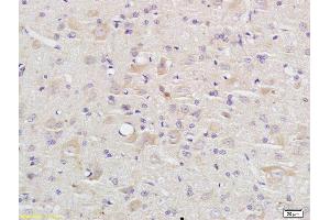 Formalin-fixed and paraffin embedded rat brain labeled with Anti Caspase-9 p10 Polyclonal Antibody, Unconjugated (ABIN1387603) at 1:200 followed by conjugation to the secondary antibody and DAB staining (Caspase 9 Antikörper  (AA 351-416))
