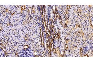 Immunohistochemistry (IHC) image for anti-Coagulation Factor VIII (F8) (AA 2253-2346) antibody (ABIN7434263)