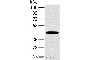 Western blot analysis of A375 cell, using MAGEA10 Polyclonal Antibody at dilution of 1:400