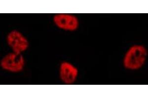 ABIN6276705 staining  Hela cells by IF/ICC. (RENT1/UPF1 Antikörper)