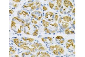Immunohistochemistry of paraffin-embedded Human stomach using SDC4 Polyclonal Antibody at dilution of 1:100 (40x lens). (SDC4 Antikörper)