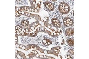 Immunohistochemical staining of human small intestine with MRPL37 polyclonal antibody  shows moderate granular positivity in glandular cells. (MRPL37 Antikörper)