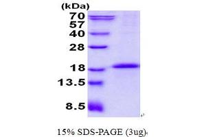 Image no. 1 for CD79b Molecule, Immunoglobulin-Associated beta (CD79B) protein (His tag) (ABIN1098714) (CD79b Protein (His tag))