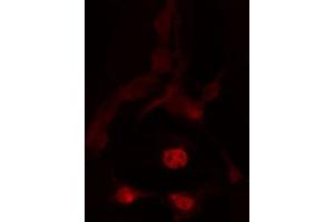 ABIN6272442 staining HeLa by IF/ICC. (TBX2 Antikörper  (C-Term))