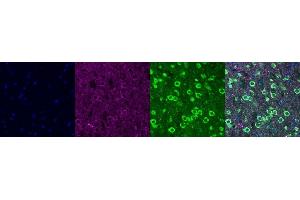 Immunohistochemistry (IHC) image for anti-Microtubule-Associated Protein 2 (MAP2) antibody (ABIN7456158)