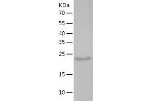 Western Blotting (WB) image for Syntaxin 17 (STX17) (AA 1-229) protein (His tag) (ABIN7286565) (Syntaxin 17 Protein (STX17) (AA 1-229) (His tag))