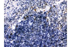 IHC testing of FFPE mouse spleen with IKAROS antibody. (IKZF1 Antikörper)