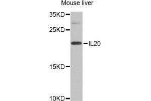 Western blot analysis of extracts of mouse liver, using IL20 Antibody. (IL-20 Antikörper)