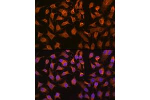 Immunofluorescence analysis of HeLa cells using PEPCK/PEPCK/PCK2 Rabbit mAb (ABIN7269306) at dilution of 1:100 (40x lens). (PEPCK Antikörper)