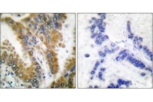 Immunohistochemistry (IHC) image for anti-V-Crk Sarcoma Virus CT10 Oncogene Homolog (Avian)-Like (CRKL) (AA 173-222) antibody (ABIN2888596) (CrkL Antikörper  (AA 173-222))