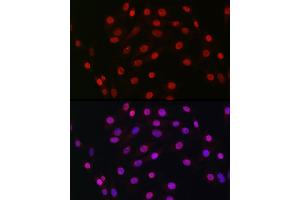 Immunofluorescence analysis of NIH/3T3 cells using HDGF Rabbit mAb (ABIN7267622) at dilution of 1:100 (40x lens). (HDGF Antikörper)