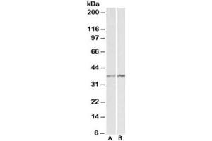 Western blot testing of K562 [A] and NIH3T3 [B] lysates with Annexin A1 antibody at 1ug/ml. (Annexin a1 Antikörper)