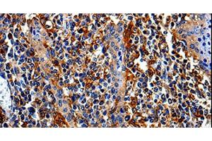 Immunohistochemistry of paraffin-embedded Human tonsil tissue using COX16 Polyclonal Antibody at dilution 1:50 (COX16 Antikörper)