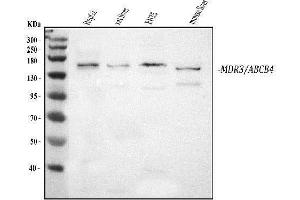 Western blot analysis of ABCB4 using anti-ABCB4 antibody (ABIN3043734).