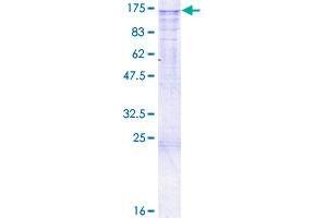 Image no. 1 for Calcium Homeostasis Endoplasmic Reticulum Protein (CHERP) (AA 1-884) protein (GST tag) (ABIN1349309) (CHERP Protein (AA 1-884) (GST tag))